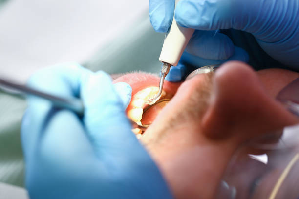 Best Emergency Root Canal Treatment in Booneville, AR